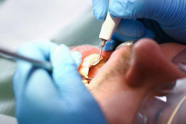 Best Dentist Open Late Near Me  in Ross, OH