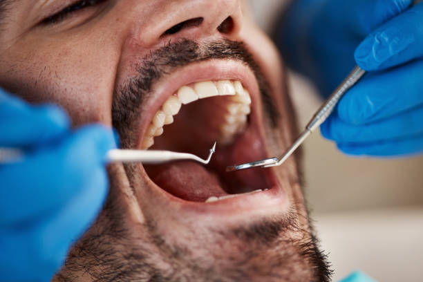 Best Emergency Tooth Extraction  in Ross, OH